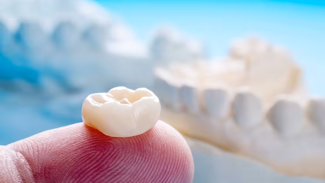 Dental Crowns Image