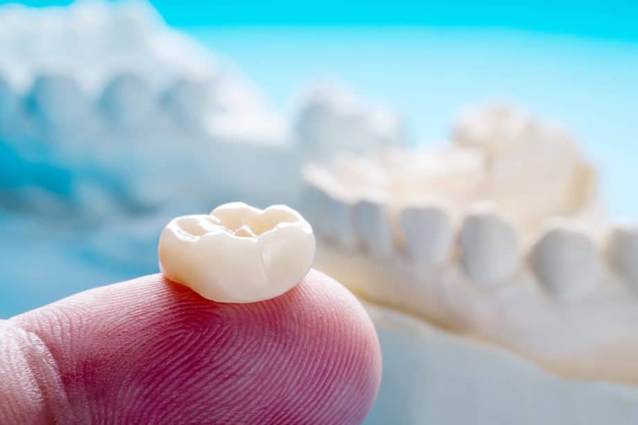 How Long Does It Take To Get A Dental Crown?