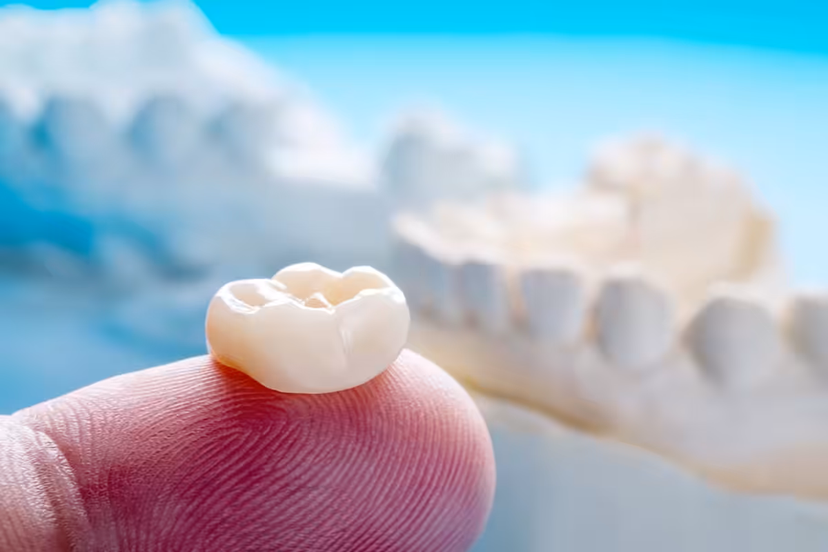 How Long Does It Take To Get A Dental Crown Blog.jpg