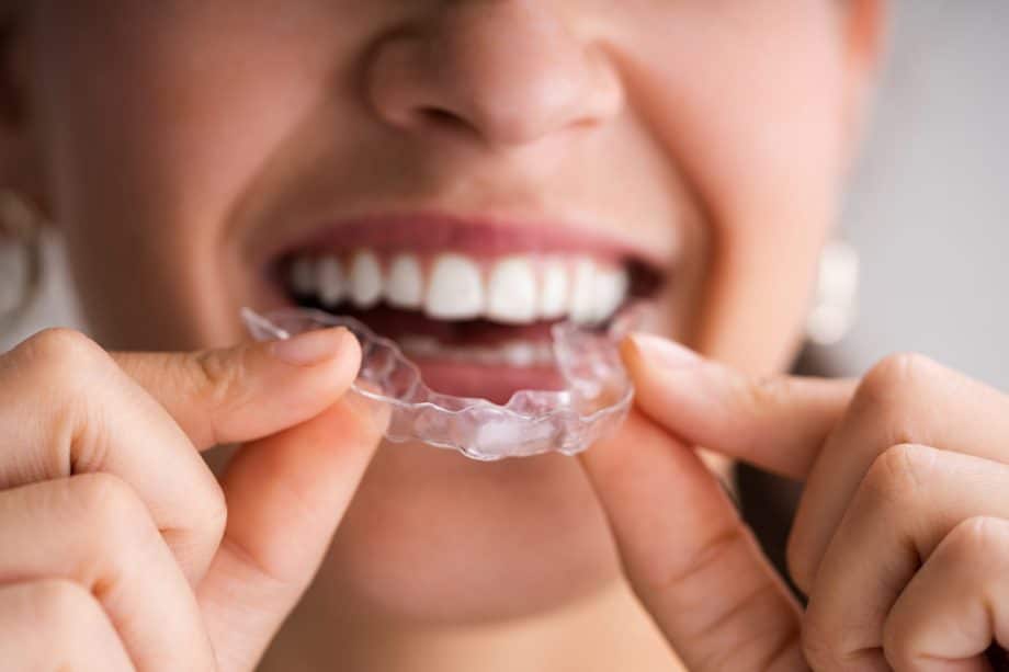 How to clean invisalign trays on the go without a toothbrush