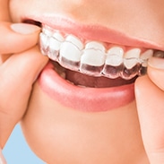 Invisalign Appliance