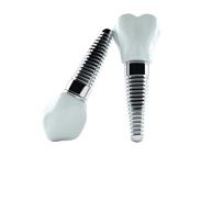 Dental Implant Image