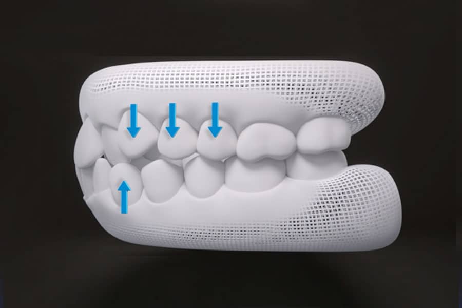 Treatment Plan Photo