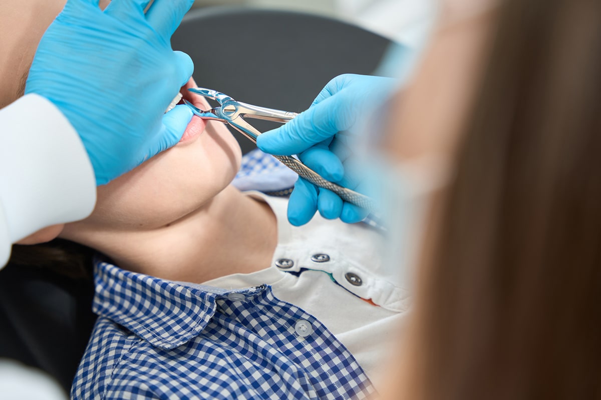 Root canal vs tooth extraction which is the better option blog