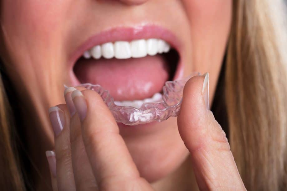 woman putting Invisalign retainer in her mouth