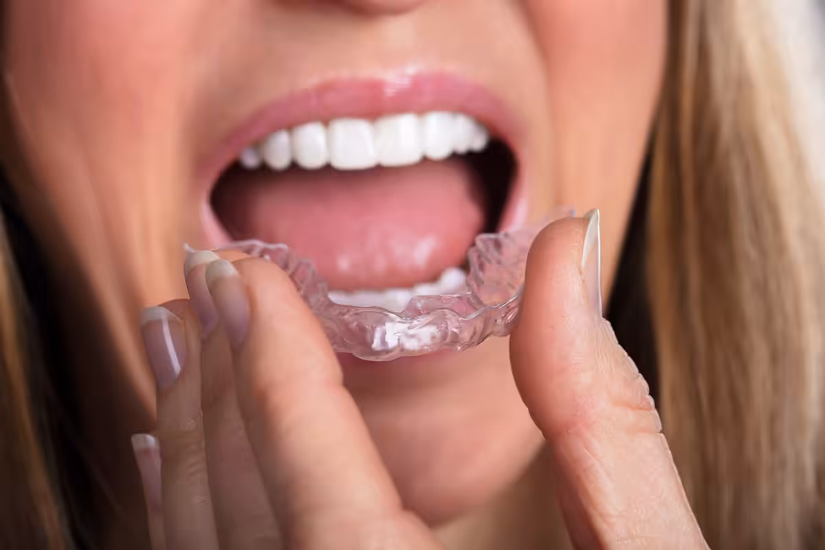 What Is Invisalign And Is It Right For You.jpg